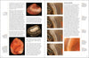 Agates of Lake Superior